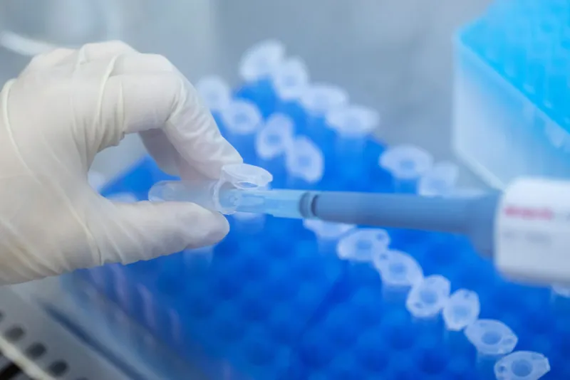 (Paul Yeung/Bloomberg)